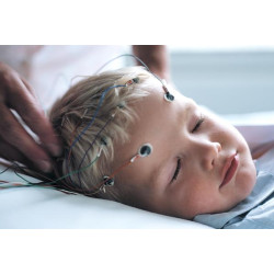 Using Ambu Neuroline 726 Cup Electrodes