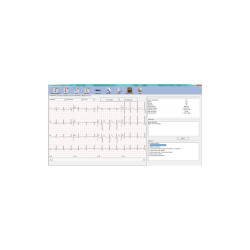 Edan SE 1010 SOFTWARE SE-1515