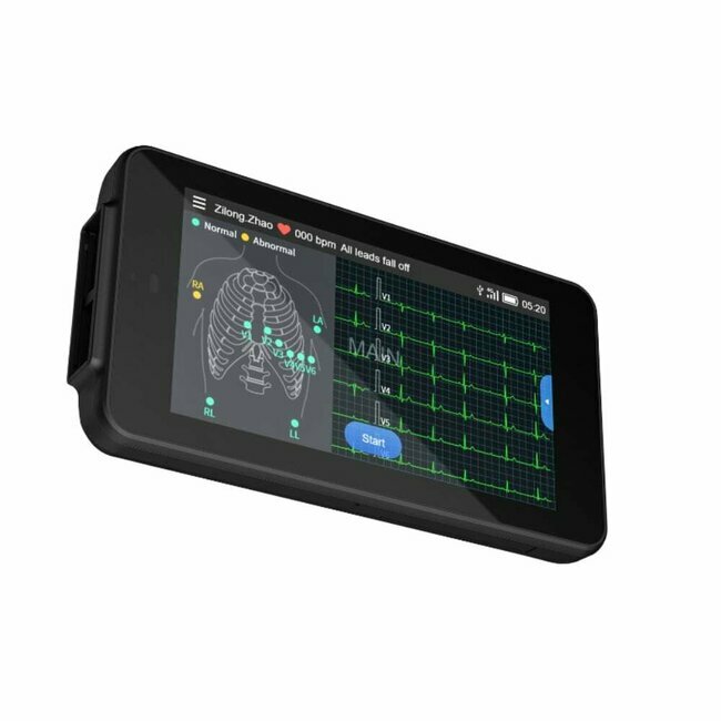 Cardio One Mini 12-lead pocket ECG device