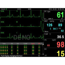 PC-3000 Multiparameter Vital Signs Monitor